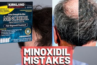minoxidil prescription mistakes for women with hair loss issues
